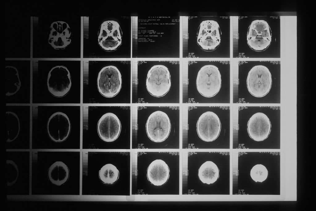 Rayos X para ver el cerebro