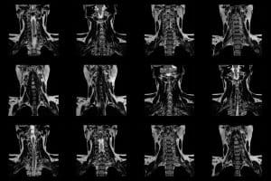Radiografía de sistema digestivo superior